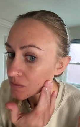 NAD+ patient testimonial video thumbnail